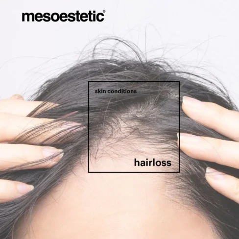 Mesoestetic®Tricology hair loss lotion 8x5ml - Afbeelding 3