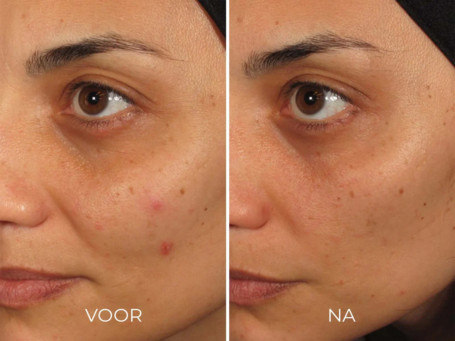 Image Skincare ILUMA Intense Facial Illuminator | UITVERKOOP - Afbeelding 2